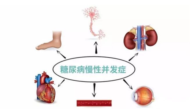 血糖波動大，并發(fā)癥來得快，糖友要多補硒